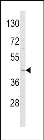 Adiponectin Receptor 1 Antibody in Western Blot (WB)