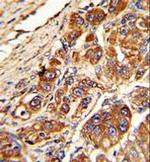 KLC1 Antibody in Immunohistochemistry (Paraffin) (IHC (P))