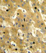SCP2 Antibody in Immunohistochemistry (Paraffin) (IHC (P))