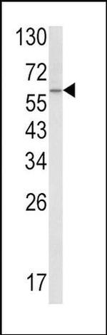 SCP2 Antibody in Western Blot (WB)