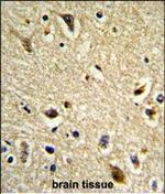 CYP2E1 Polyclonal Antibody