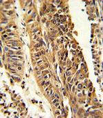 CYP4B1 Antibody in Immunohistochemistry (Paraffin) (IHC (P))