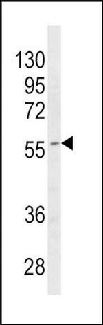 CYP4B1 Antibody in Western Blot (WB)