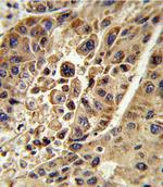 KMO Polyclonal Antibody