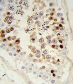 SNAIL Antibody in Immunohistochemistry (Paraffin) (IHC (P))