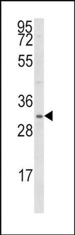 SNAIL Antibody in Western Blot (WB)