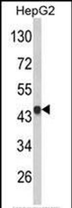 VPS26A Antibody in Western Blot (WB)