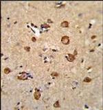 Annexin A7 Antibody in Immunohistochemistry (Paraffin) (IHC (P))
