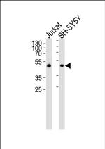 Annexin A7 Antibody in Western Blot (WB)
