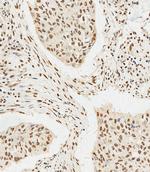 HSPA7 Polyclonal Antibody