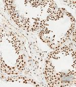 HSPA7 Antibody in Immunohistochemistry (Paraffin) (IHC (P))