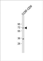 HSPA7 Antibody in Western Blot (WB)