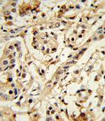 BMI-1 Antibody in Immunohistochemistry (Paraffin) (IHC (P))