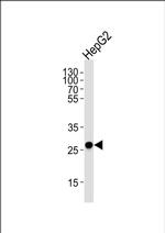DCI Antibody in Western Blot (WB)