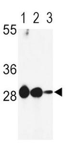 DCI Antibody in Western Blot (WB)