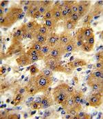 CYP8B1 Antibody in Immunohistochemistry (Paraffin) (IHC (P))