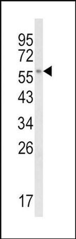CYP8B1 Antibody in Western Blot (WB)
