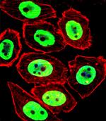EWSR1 Antibody in Immunocytochemistry (ICC/IF)