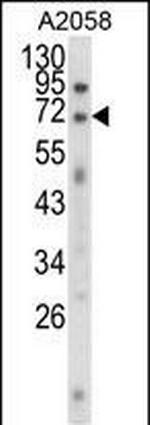 EWSR1 Antibody in Western Blot (WB)