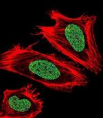 UHRF1 Antibody in Immunocytochemistry (ICC/IF)