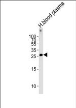 C1QB Antibody in Western Blot (WB)