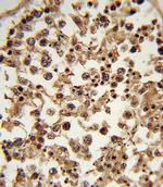 ETV6 Antibody in Immunohistochemistry (Paraffin) (IHC (P))