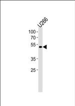 ETV6 Antibody in Western Blot (WB)