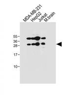 EMX1 Polyclonal Antibody