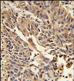 gamma Catenin Antibody in Immunohistochemistry (Paraffin) (IHC (P))
