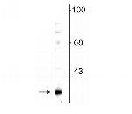 GSTK1 Antibody in Western Blot (WB)