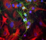 alpha-II Spectrin Antibody in Immunocytochemistry (ICC/IF)