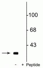 Phospho-DARPP-32 (Ser137) Polyclonal Antibody