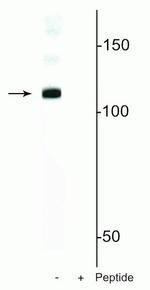 Phospho-DGCR8 (Ser377) Polyclonal Antibody