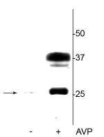 Phospho-Aquaporin 2 (Ser264) Polyclonal Antibody