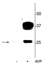 Phospho-Aquaporin 2 (Ser269) Polyclonal Antibody