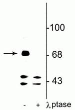 Phospho-FMRP (Ser499) Polyclonal Antibody