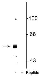 Phospho-GABRB3 (Ser408, Ser409) Polyclonal Antibody
