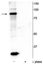 Phospho-ATRIP (Ser239) Polyclonal Antibody