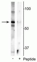 Phospho-MECP2 (Ser421) Polyclonal Antibody