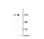 Phospho-mGluR7 (Ser862) Polyclonal Antibody