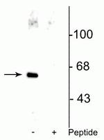 Phospho-AATF (Ser477) Polyclonal Antibody