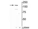 Phospho-NMDAR2A (Tyr1325) Polyclonal Antibody