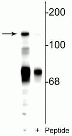 Phospho-NMDAR2C (Ser1244) Polyclonal Antibody