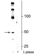 Phospho-EEF1A2 (Ser358) Polyclonal Antibody