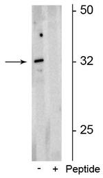 Phospho-OLIG2 (Ser10, Ser13, Ser14) Polyclonal Antibody