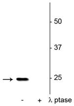 Phospho-SNAP25 (Ser187) Polyclonal Antibody