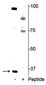 Phospho-DDIT4 (Thr23, Thr25) Polyclonal Antibody