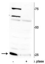 Phospho-Cardiac Troponin I (Ser150) Polyclonal Antibody
