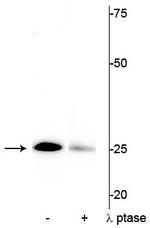 Phospho-Cardiac Troponin I (Ser43) Polyclonal Antibody