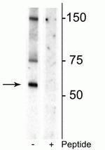 Phospho-Dopamine Transporter (Thr53) Polyclonal Antibody
